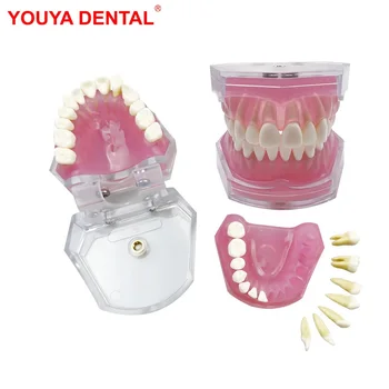 Pregledna Zobni Model Zobne Korenine Vidni Zobni Typodont Model Z Odstranljivo Zob Mehke Gumi Zob, Ekstrakcija Pratice Modeli